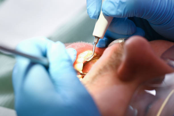 Best Emergency Treatment for Toothache in White Meadow Lake, NJ