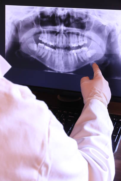 Best Emergency Dental Surgery in White Meadow Lake, NJ
