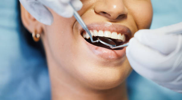 Best Emergency Broken Tooth Repair in White Meadow Lake, NJ